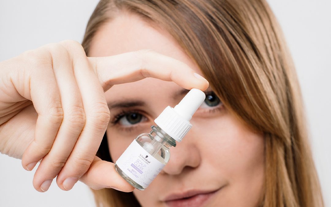 A menudo tengo caspa. ¿Cómo debería cuidar el cuero cabelludo?